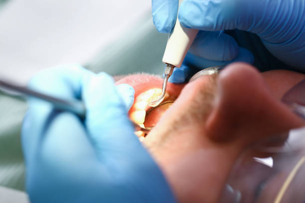 Best Tooth Pain Emergency Relief  in Shell Valley, ND