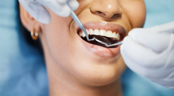 Best Walk-In Dentist Near Me  in Shell Valley, ND